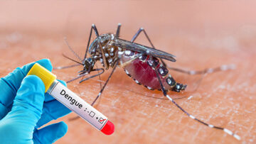 Dengue